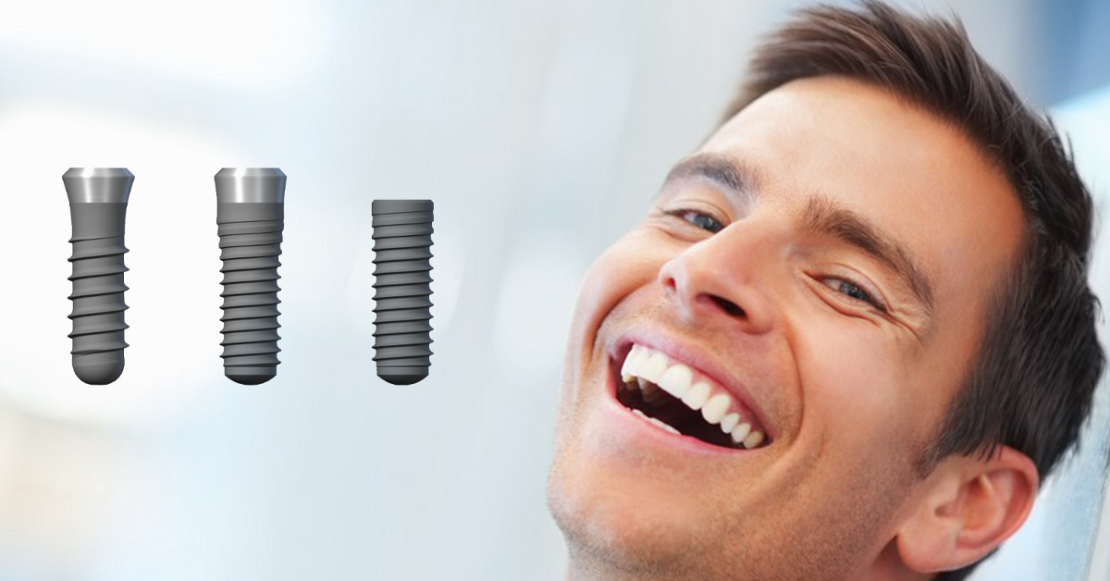 Kiedy zabraknie zęba… 5 powodów, dla których warto wybrać implant