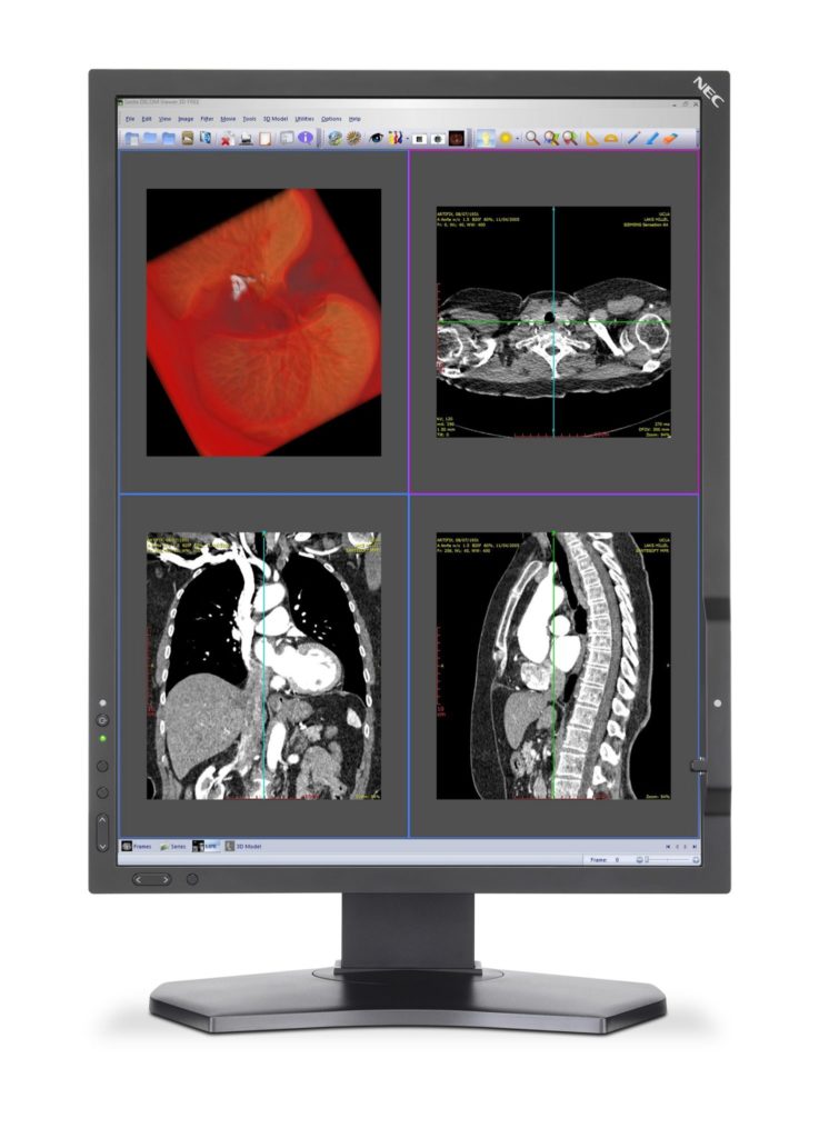 Nowa seria monitorów medycznych w ofercie NEC: Medical Display Clinical