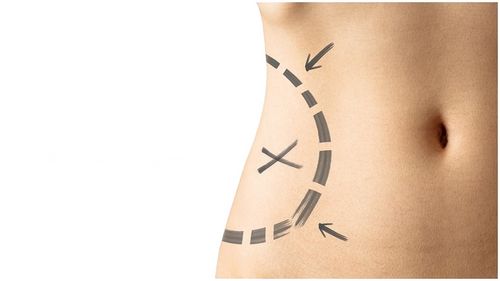 Komórki macierzyste z tkanki tłuszczowej