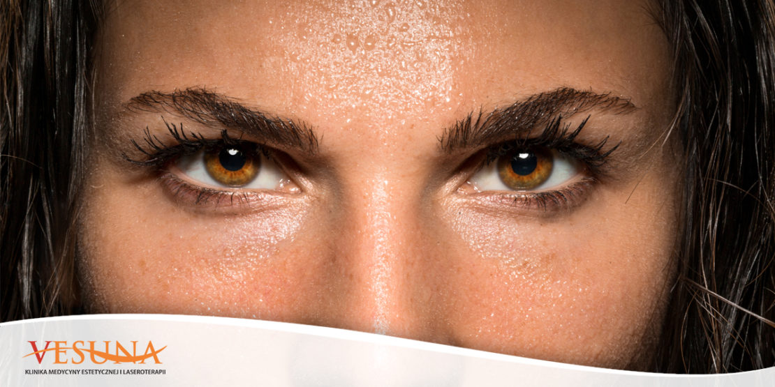 Nadpotliwość – jak walczyć z nią przez cały rok?